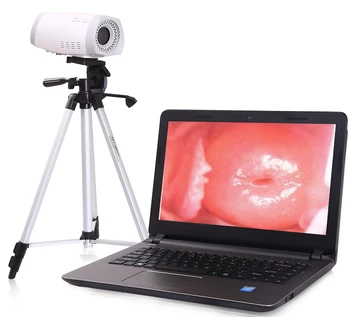 Jinekoloji için tripod ile MCL300 En uygun maliyetli taşınabilir dijital video kolposkop cihazı